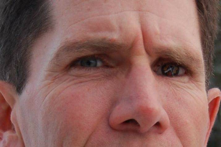 Close-up of a man’s eyes.